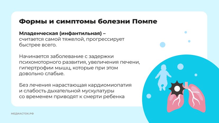 Болезнь Помпе горизонталь 04