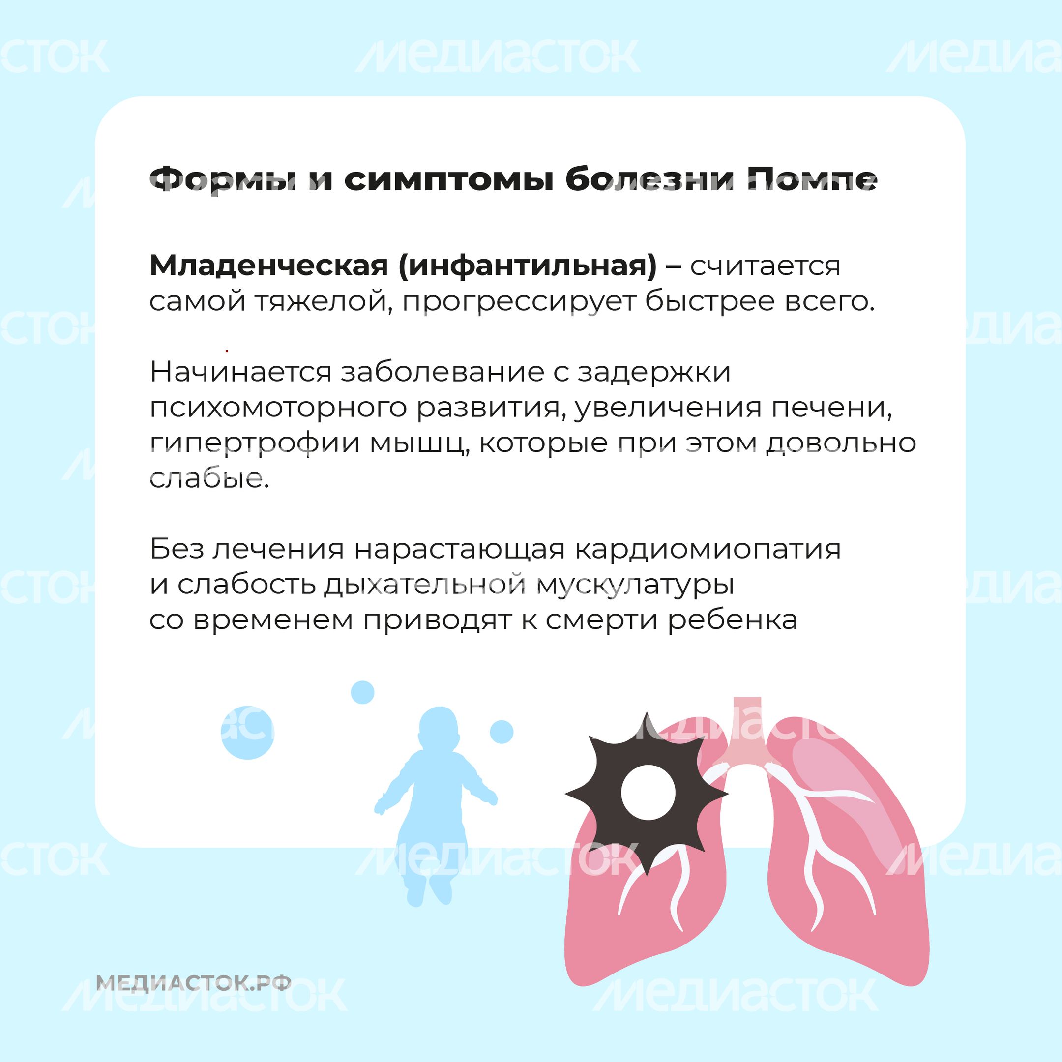 Болезнь Помпе квадрат 04 Болезнь Помпе квадрат 04