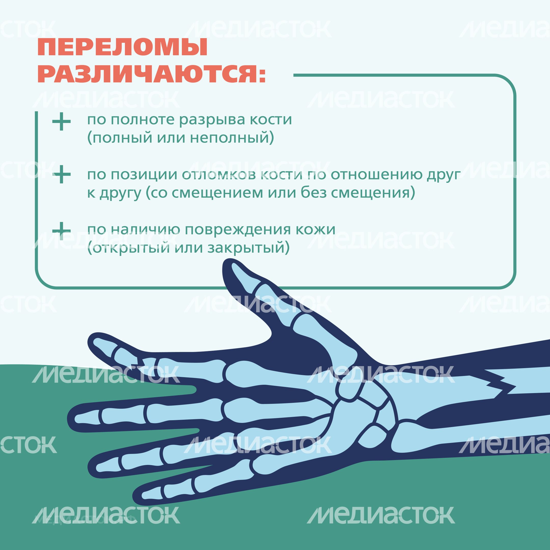 Первая помощь при переломах Квадрат 03 Первая помощь при переломах Квадрат 03