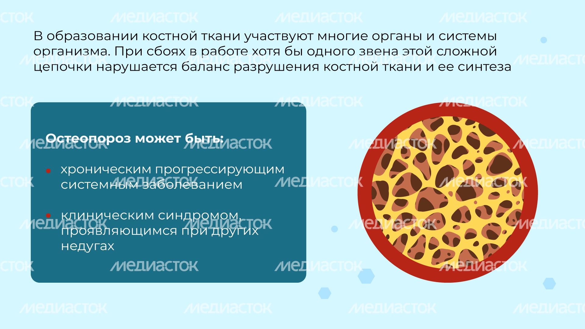 профилактика_остеопороза_горизонталь_03.jpg