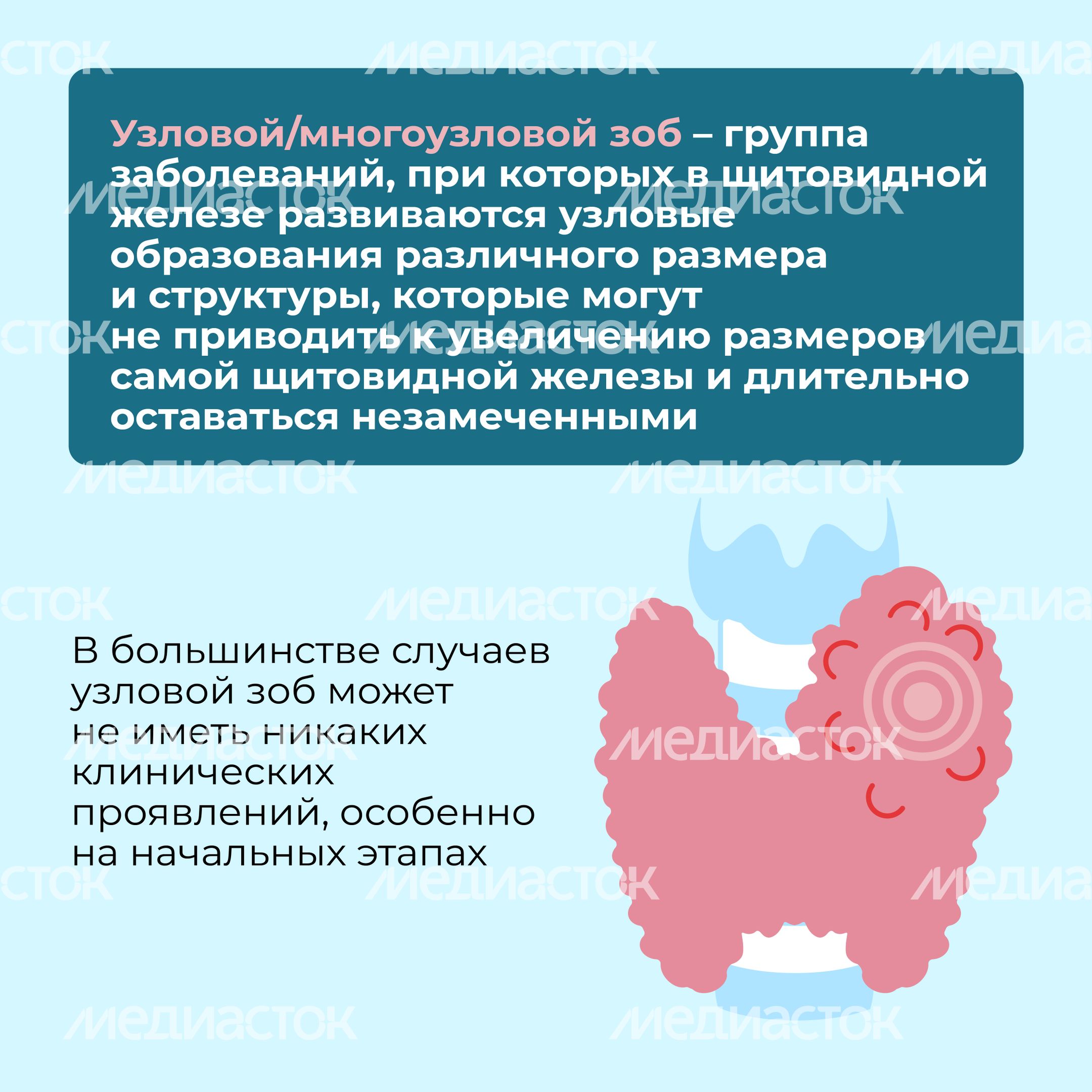 Заболевания щитовидной железы Квадрат 08