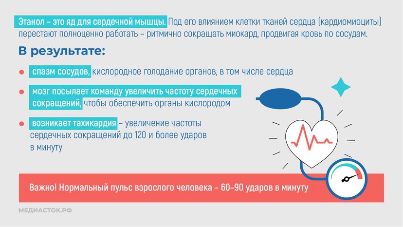 Алкогольная кардиомиопатия горизонталь 03