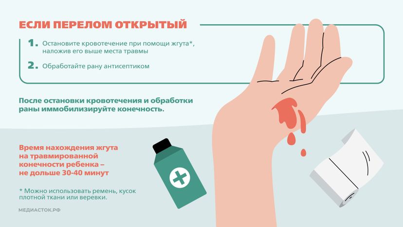 Первая помощь при переломах Горизонталь 06
