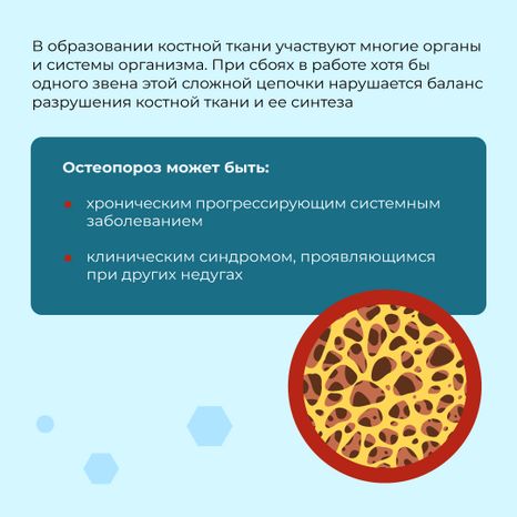 профилактика_остеопороза_квадрат_03.jpg