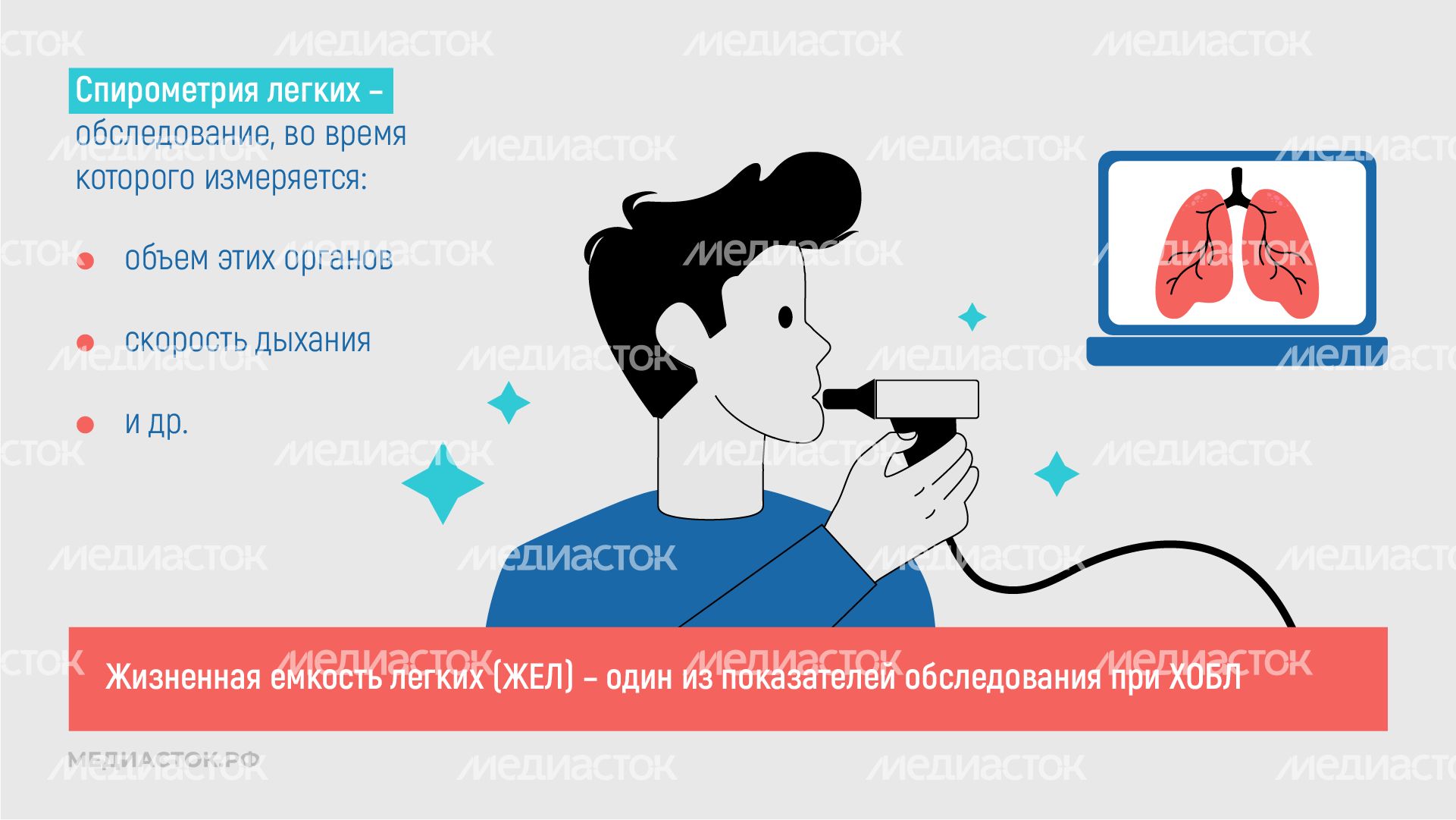 Курение и хроническая обструктивная болезнь легких горизонталь 07 Курение и хроническая обструктивная болезнь легких горизонталь 07