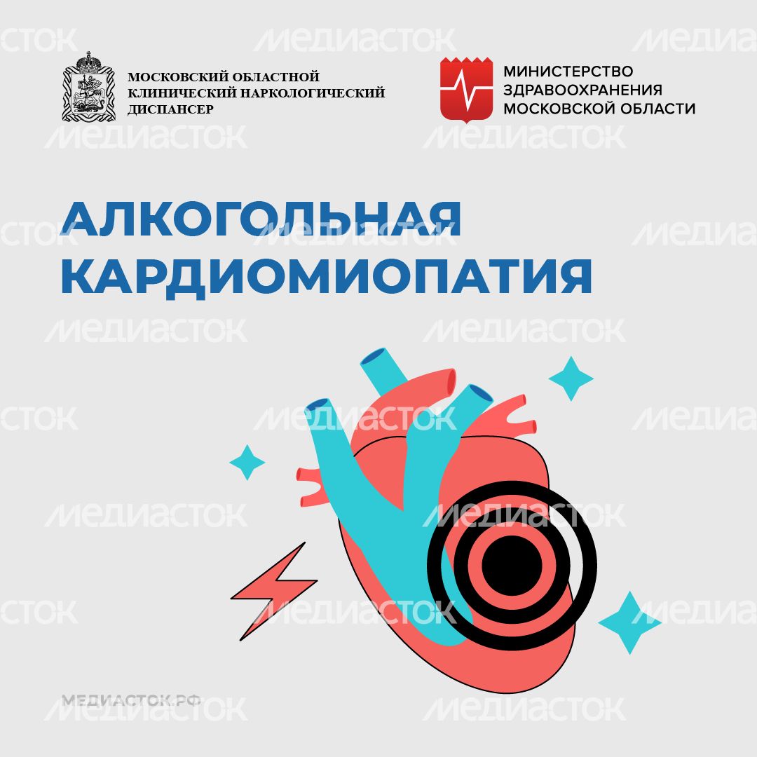 Алкогольная кардиомиопатия квадрат 01 Алкогольная кардиомиопатия квадрат 01