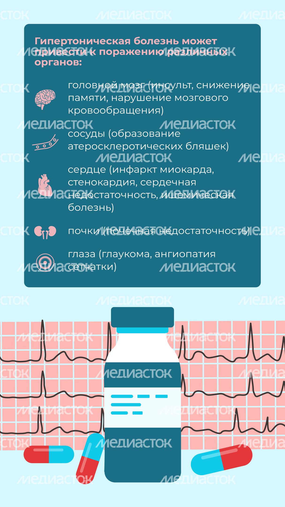 Гипертония Вертикаль 09