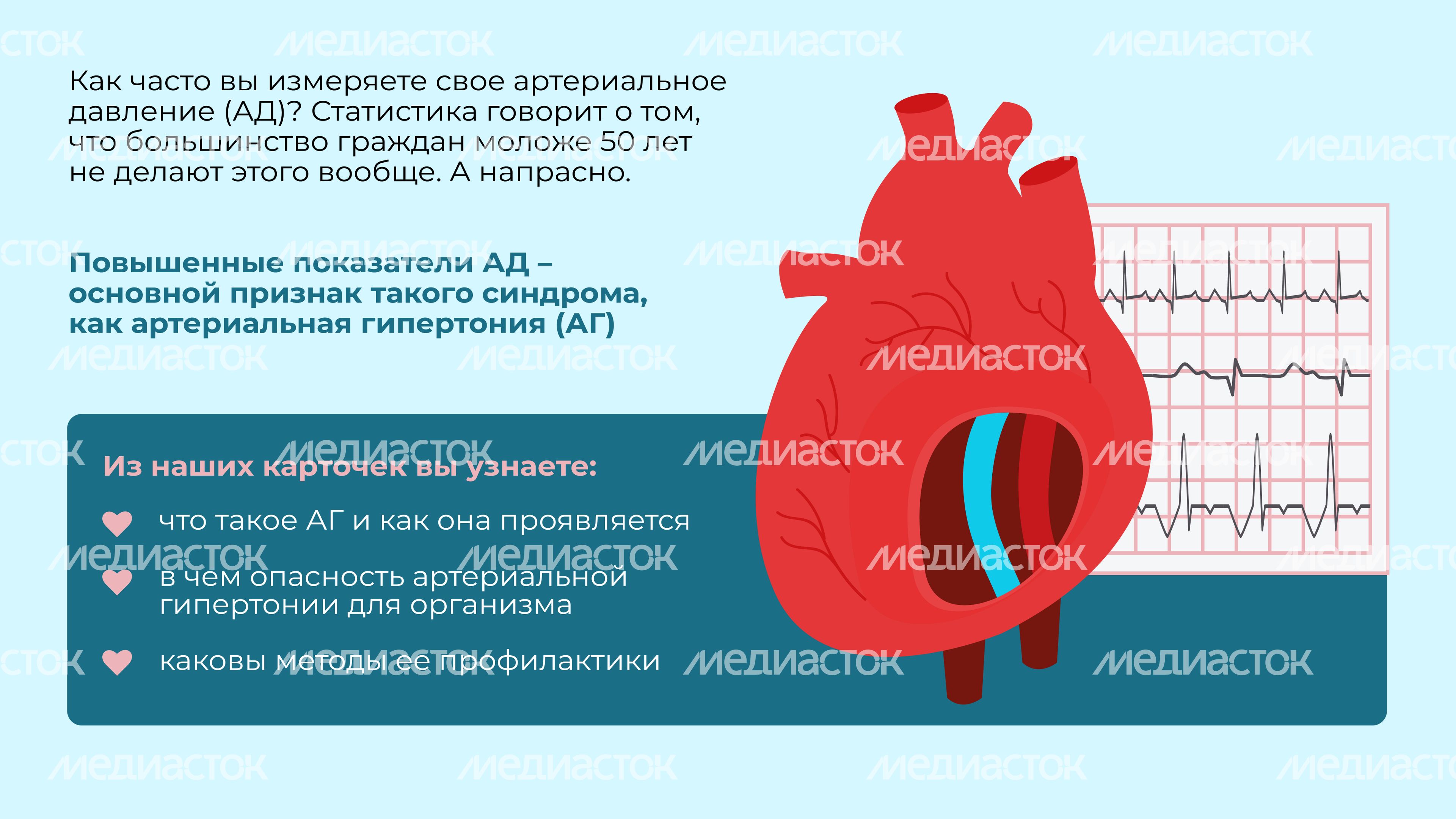 Гипертония Горизонталь 02