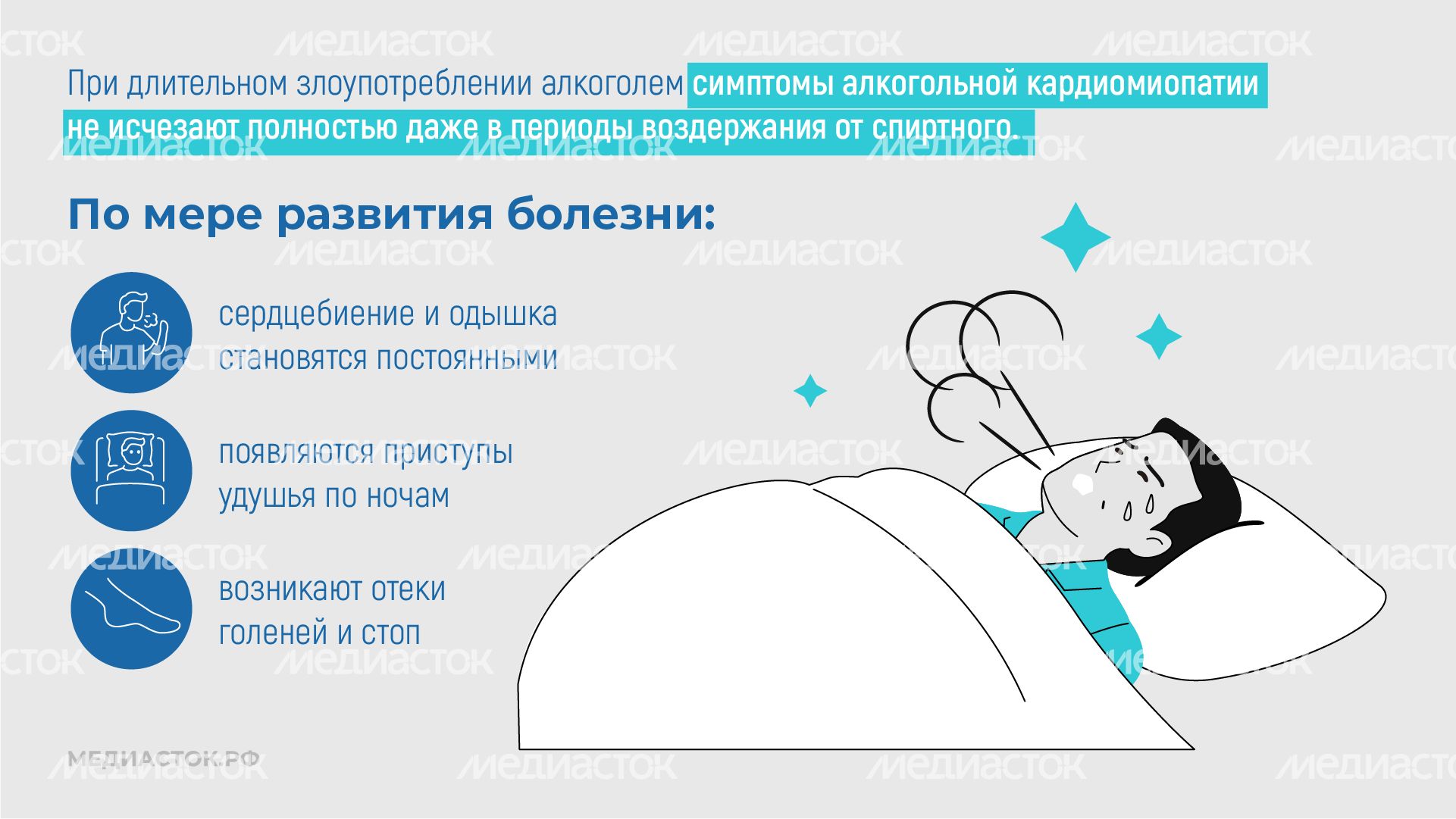 Алкогольная кардиомиопатия горизонталь 07 Алкогольная кардиомиопатия горизонталь 07