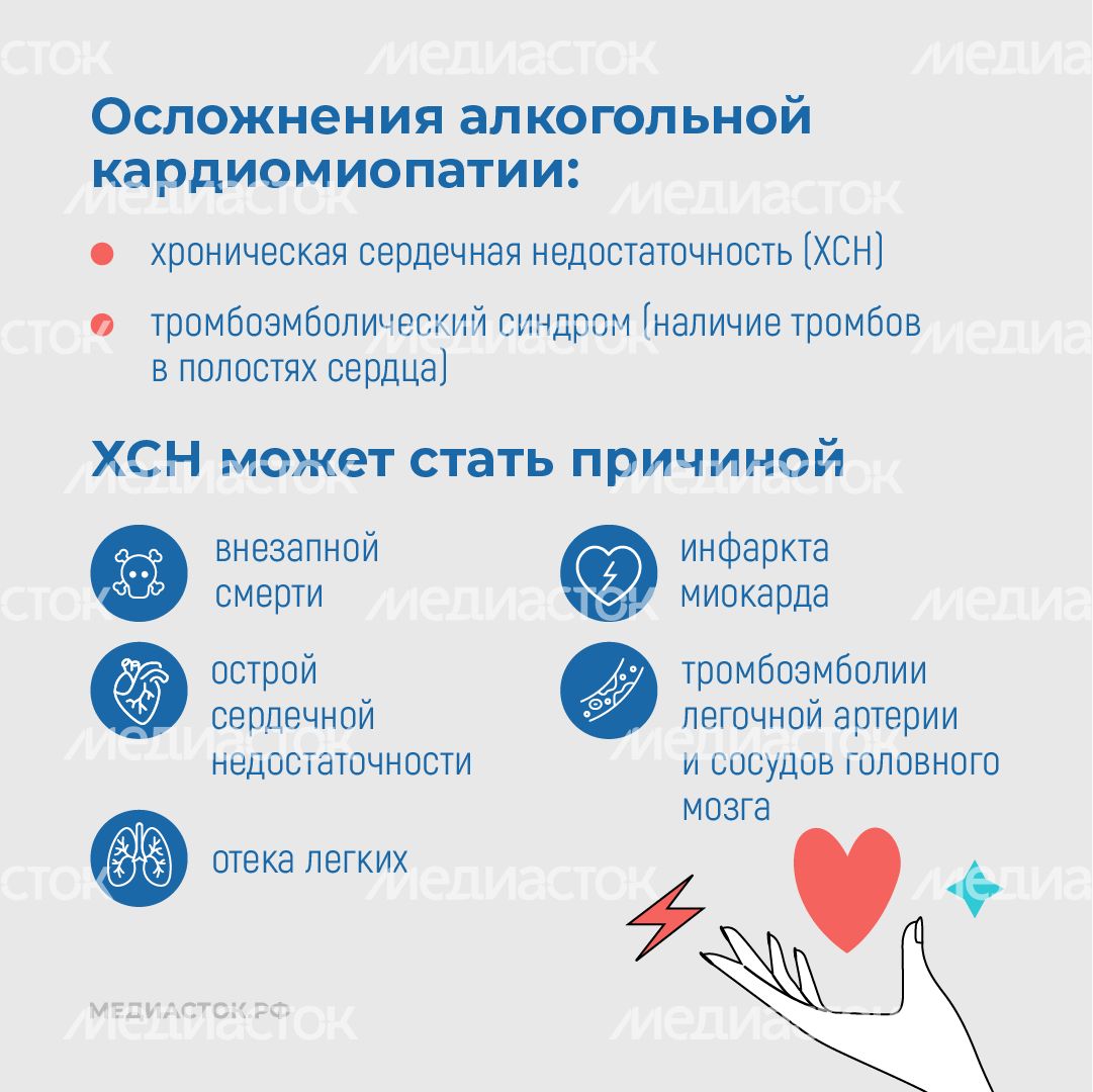 Алкогольная кардиомиопатия квадрат 08 Алкогольная кардиомиопатия квадрат 08