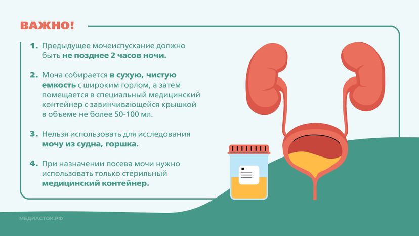 Подготовка к исследованию мочи Горизонталь 06