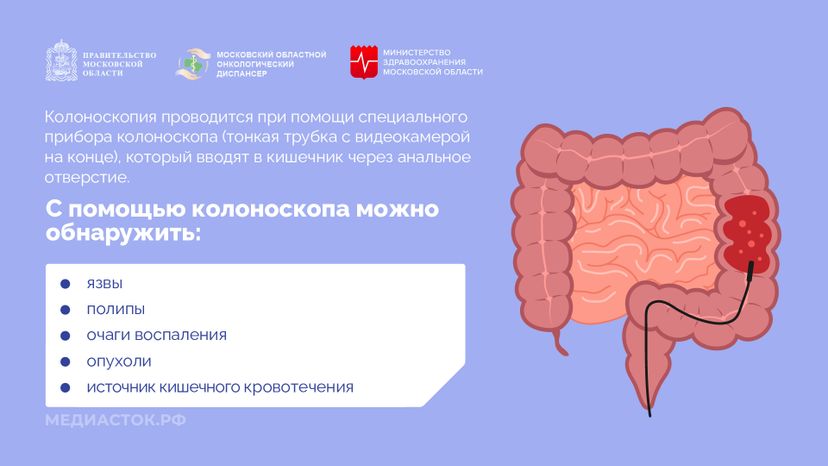 Колоноскопия горизонталь 03