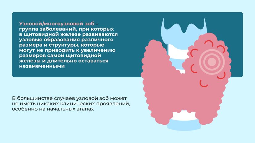Заболевания щитовидной железы Горизонталь 08