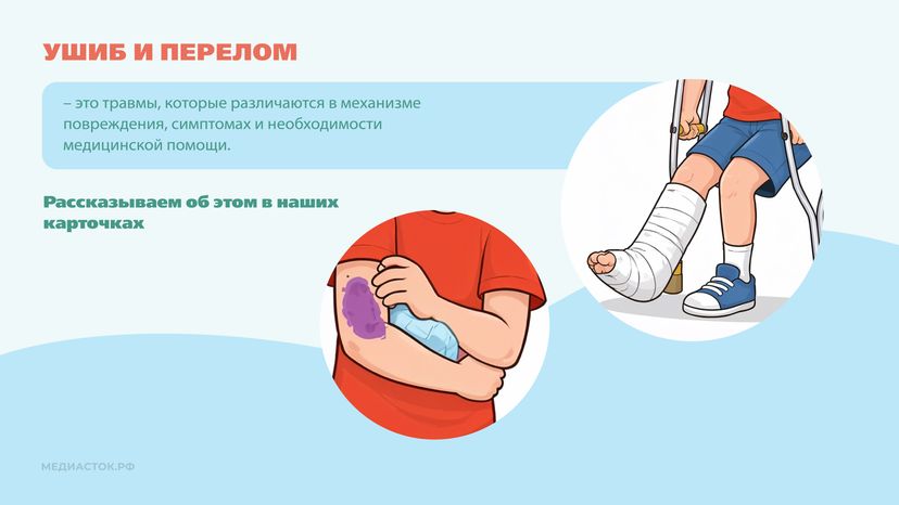 Перелом или ушиб Горизонталь 02