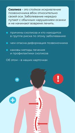 Чем опасен сколиоз вертикаль (2)