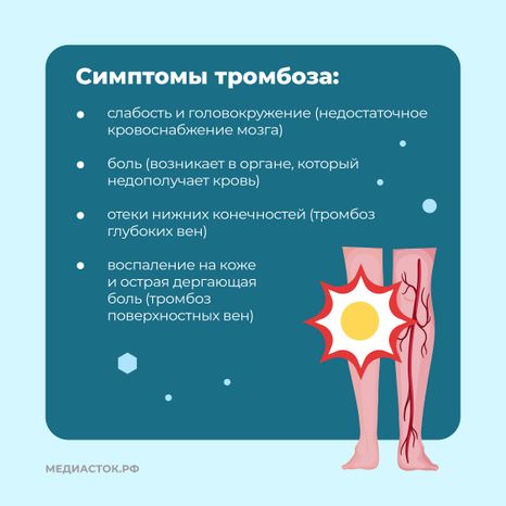 Тромбоз квадрат 06