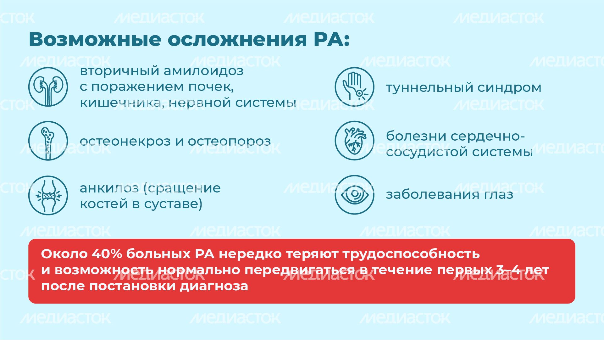 Ревматоидный артрит - горизонталь-06