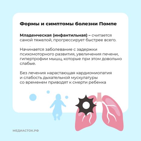 Болезнь Помпе квадрат 04