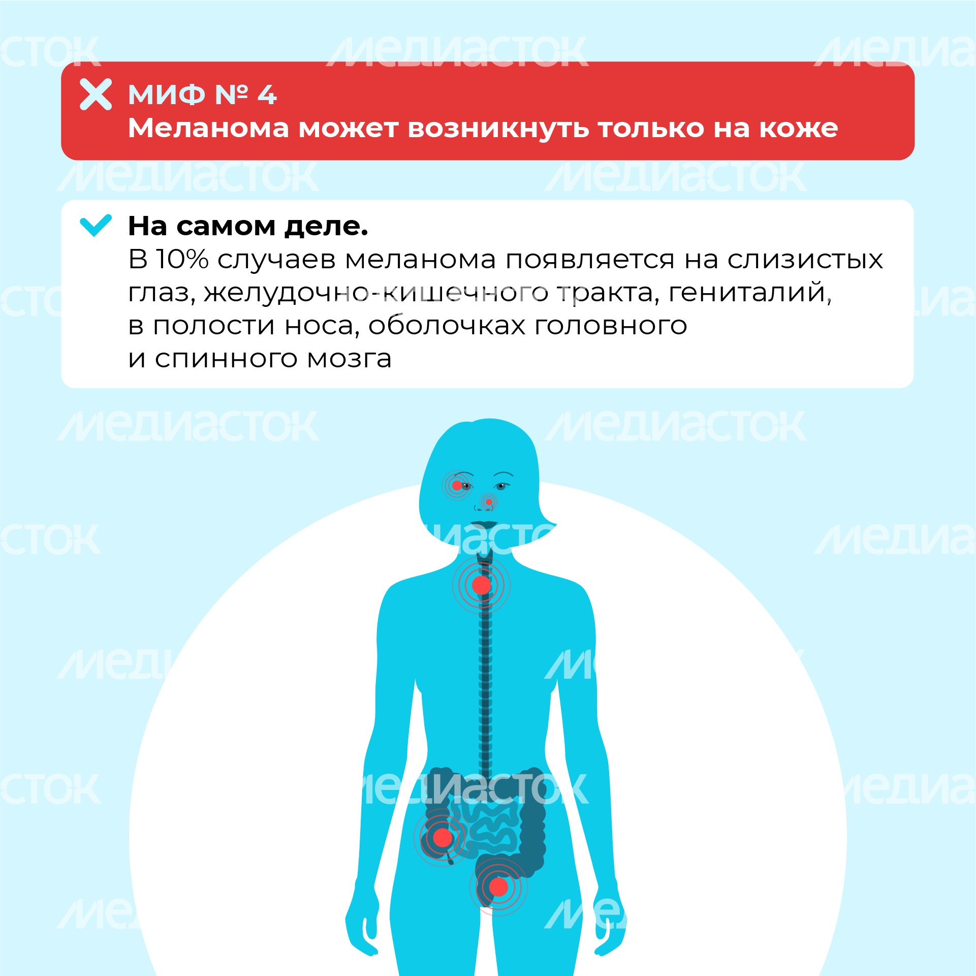 Правда и мифы о меланоме квадрат (7) Правда и мифы о меланоме квадрат (7)