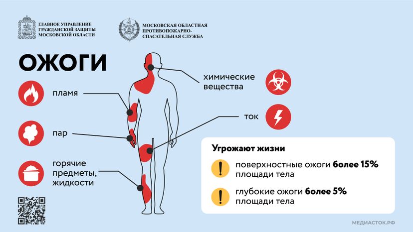 Первая помощь при ожогах Горизонталь 01