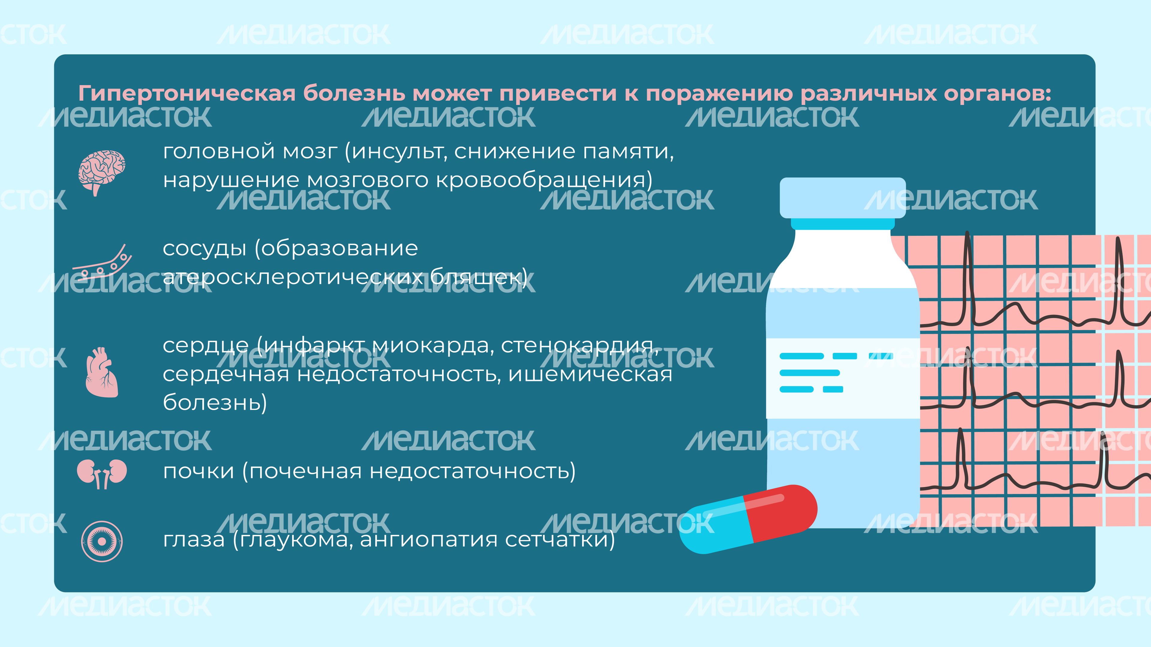 Гипертония Горизонталь 10