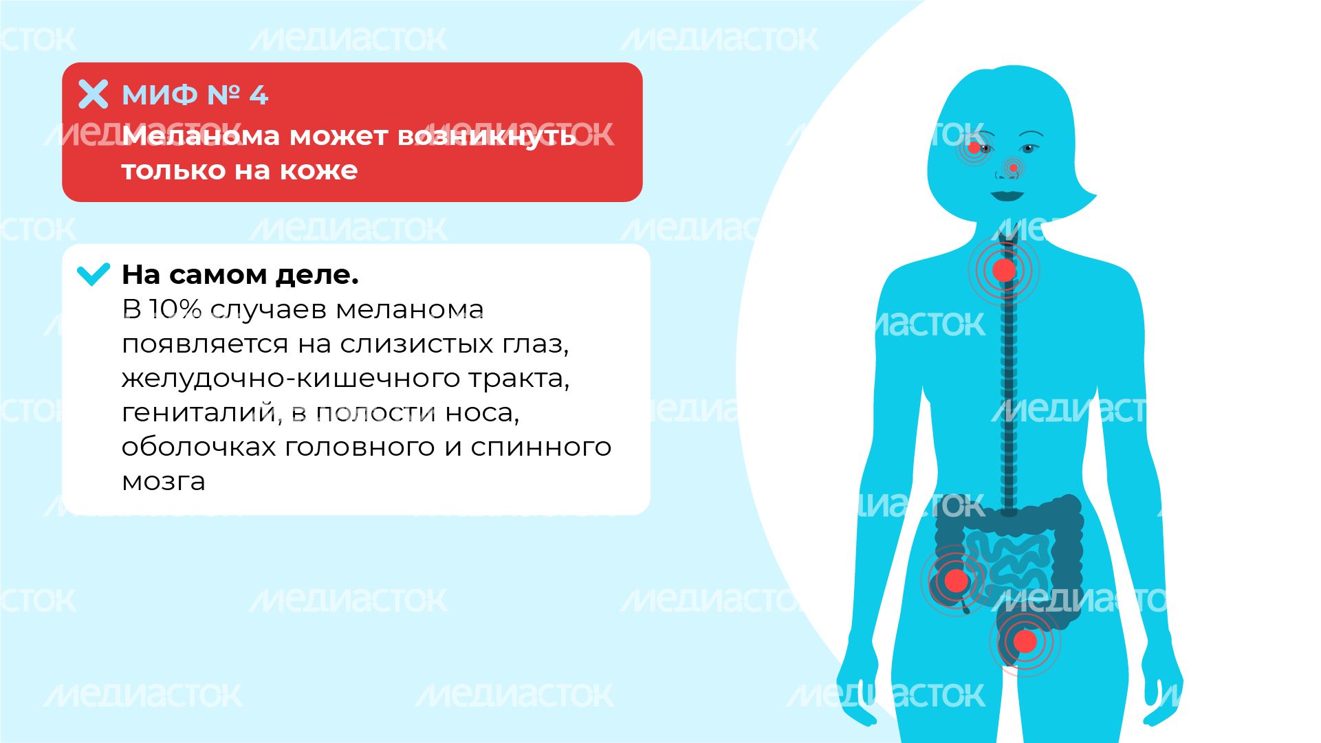 Правда и мифы о меланоме горизонталь (7) Правда и мифы о меланоме горизонталь (7)