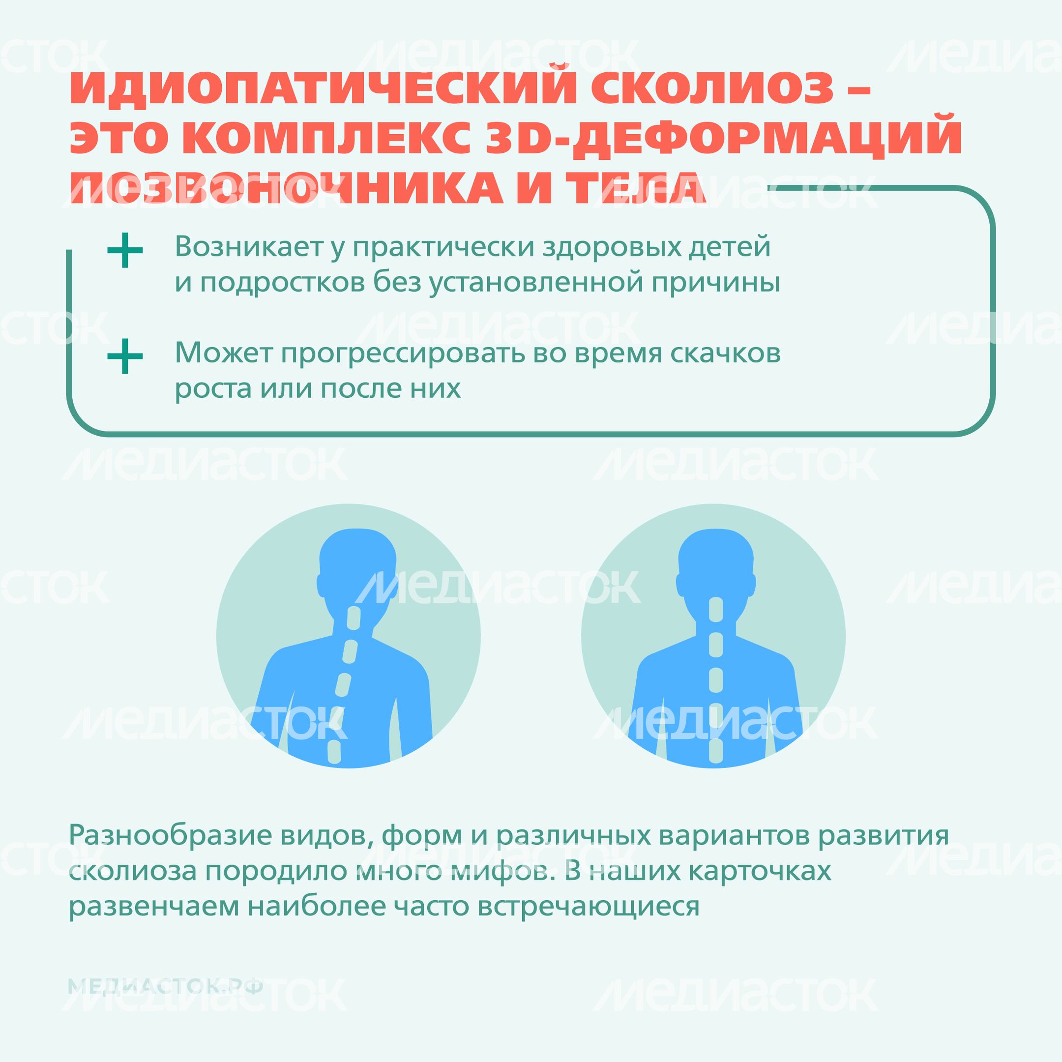 Идиопатический сколиоз мифы и правда квадрат 02 Идиопатический сколиоз мифы и правда квадрат 02