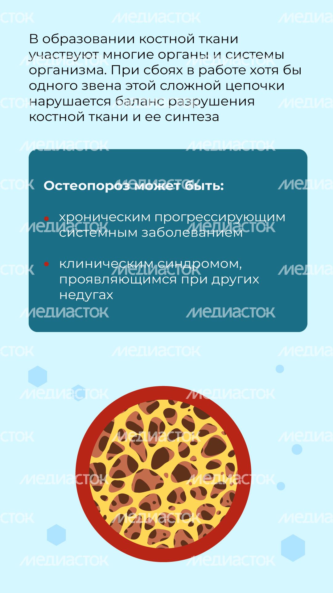 профилактика_остеопороза_вертикаль_03.jpg