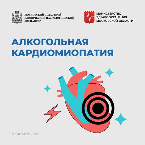 Алкогольная кардиомиопатия квадрат 01
