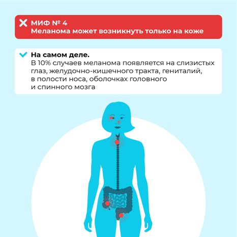 Правда и мифы о меланоме квадрат (7)
