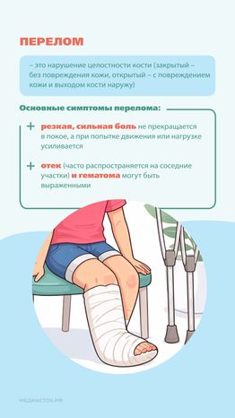 Перелом или ушиб Вертикаль 05