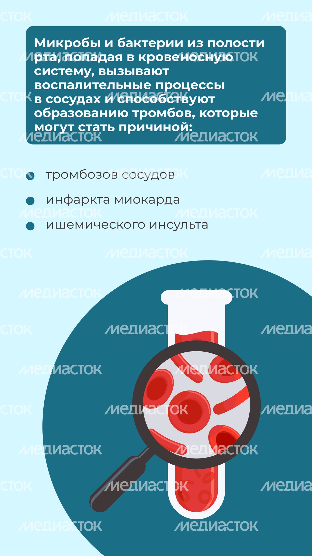 Кариес вертикаль 10 Кариес вертикаль 10