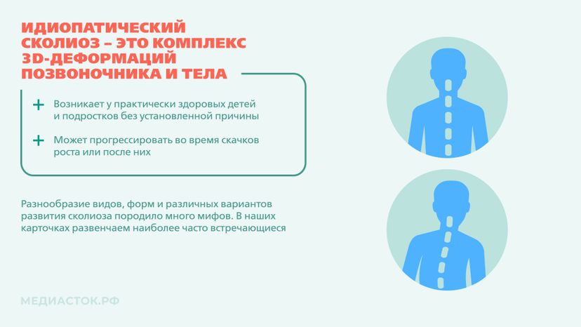 Идиопатический сколиоз мифы и правда горизонталь 02