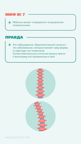 Идиопатический сколиоз мифы и правда вертикаль 07