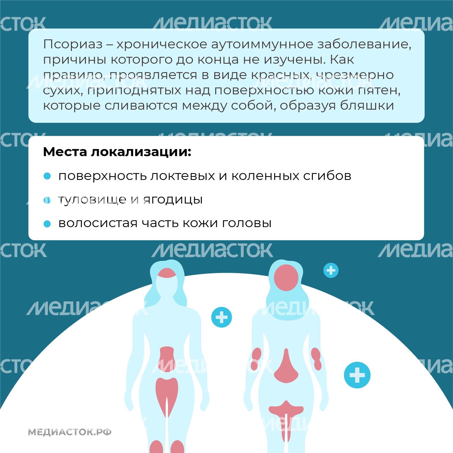 7 мифов о псориазе квадрат (3) 7 мифов о псориазе квадрат (3)
