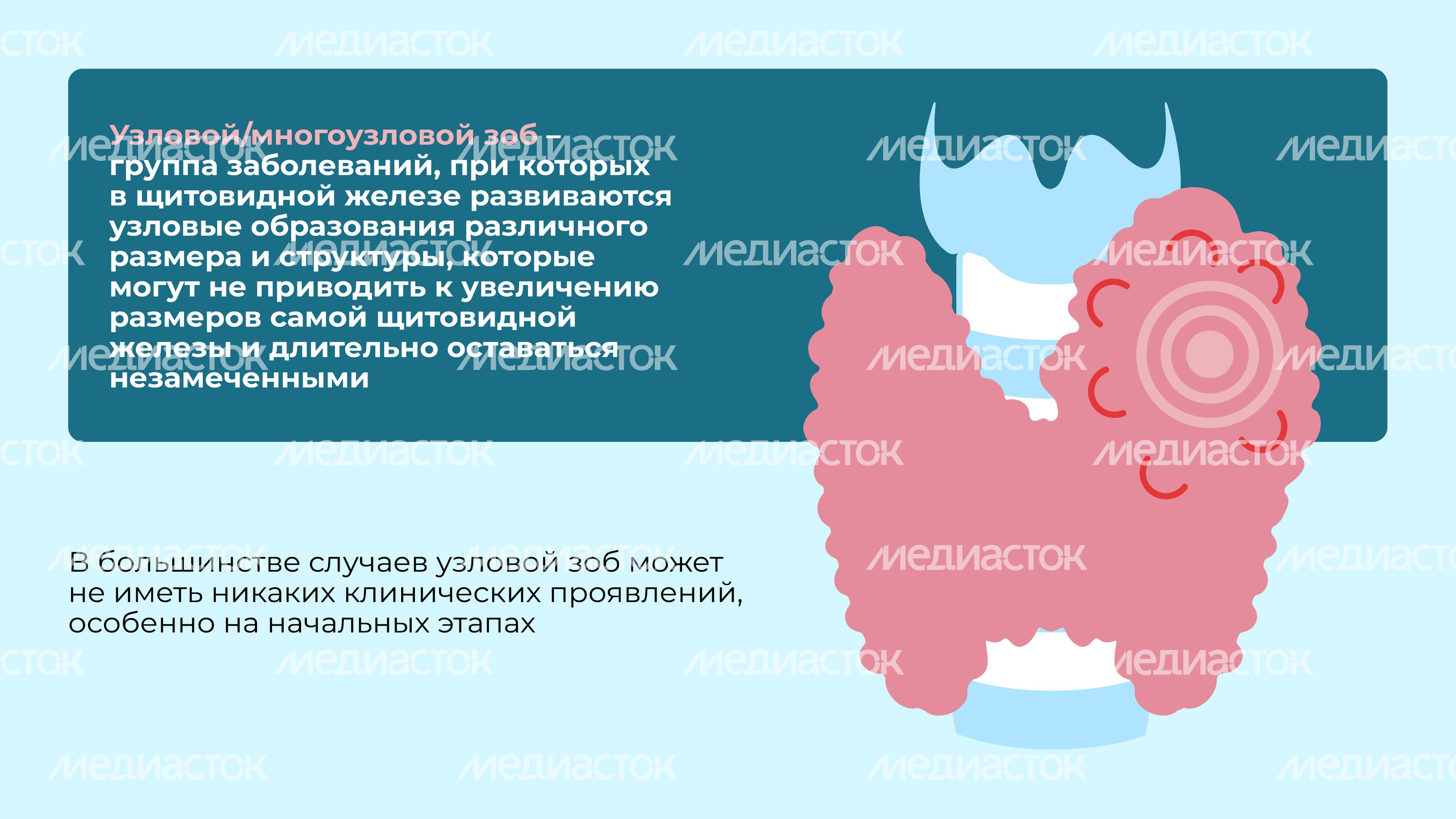 Заболевания щитовидной железы Горизонталь 08