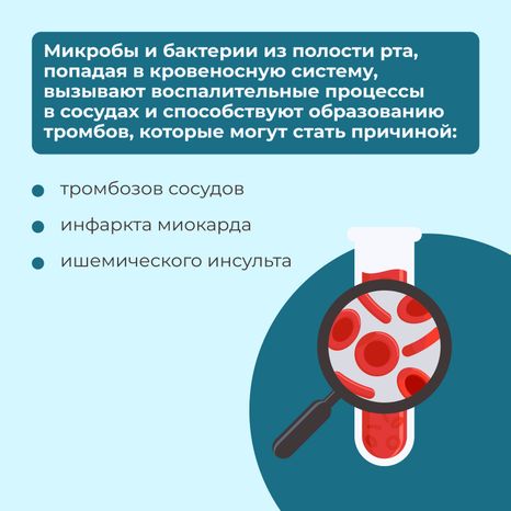 Кариес квадрат 10