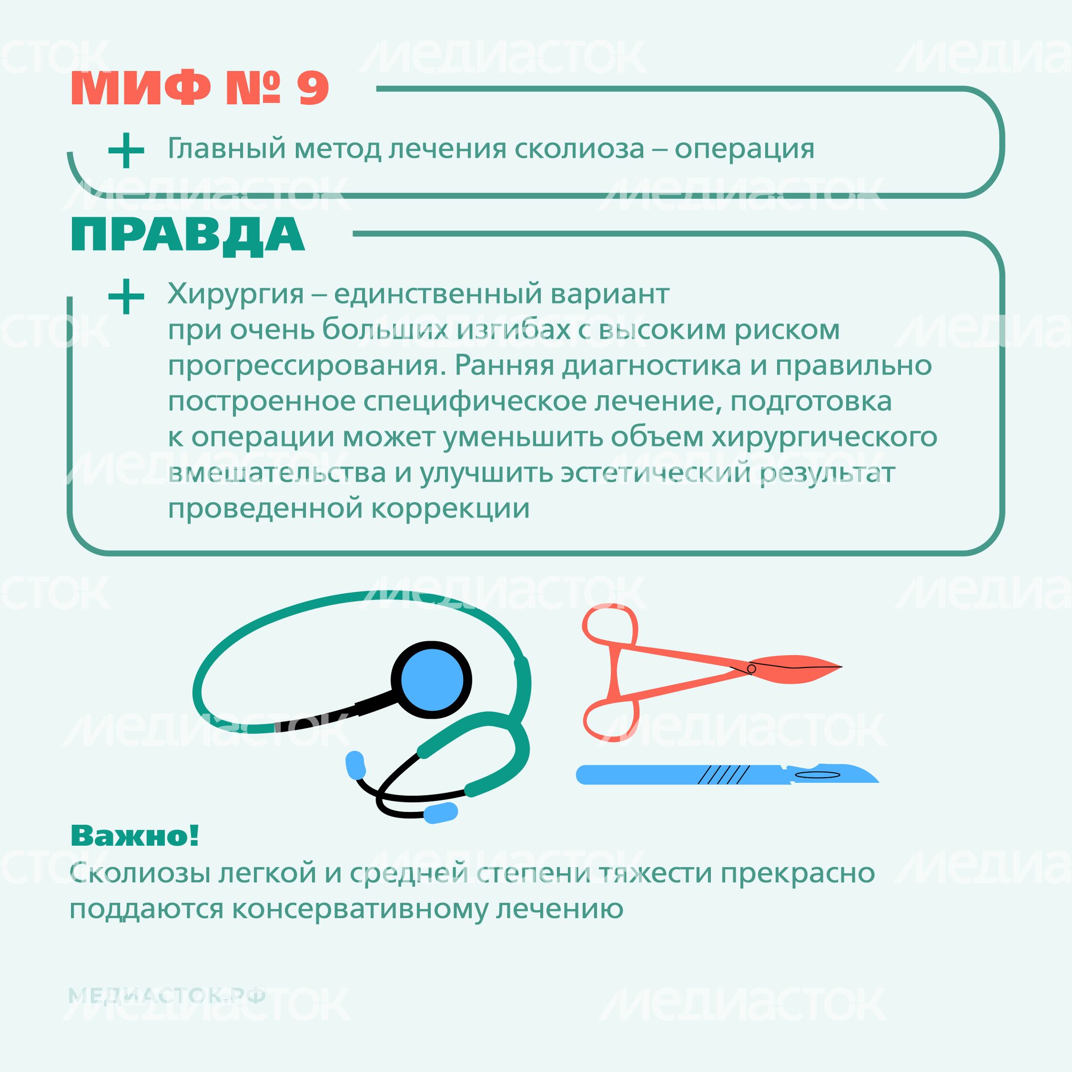 Идиопатический сколиоз мифы и правда квадрат 09 Идиопатический сколиоз мифы и правда квадрат 09