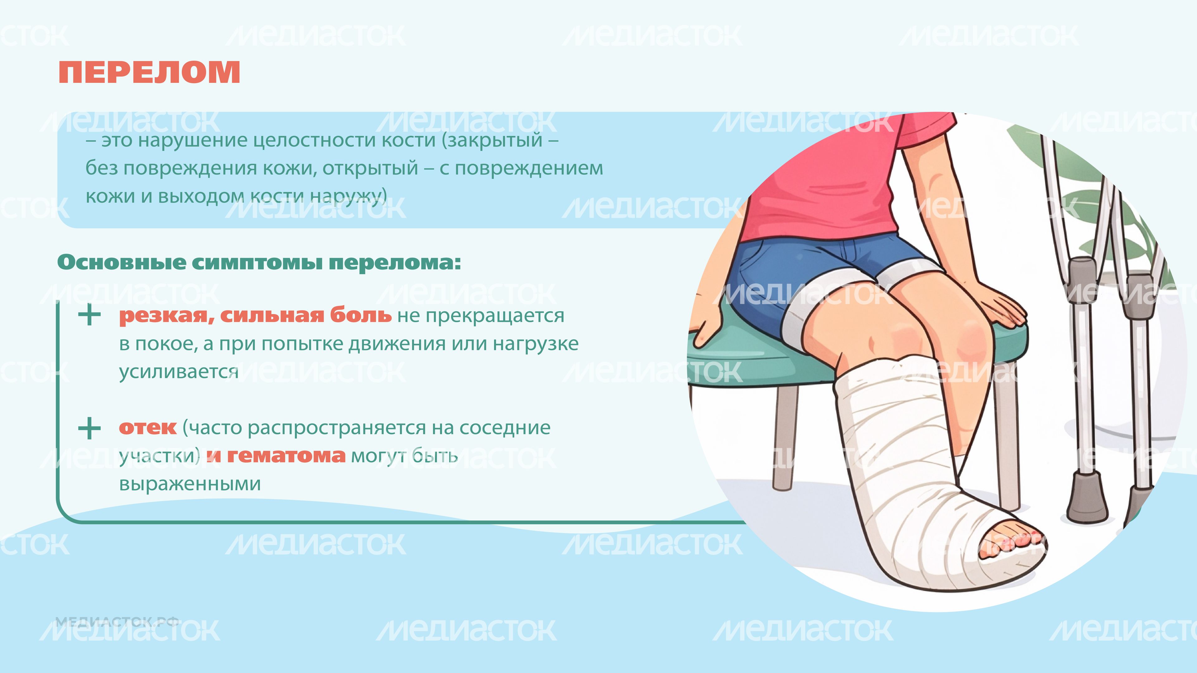 Перелом или ушиб Горизонталь 05 Перелом или ушиб Горизонталь 05