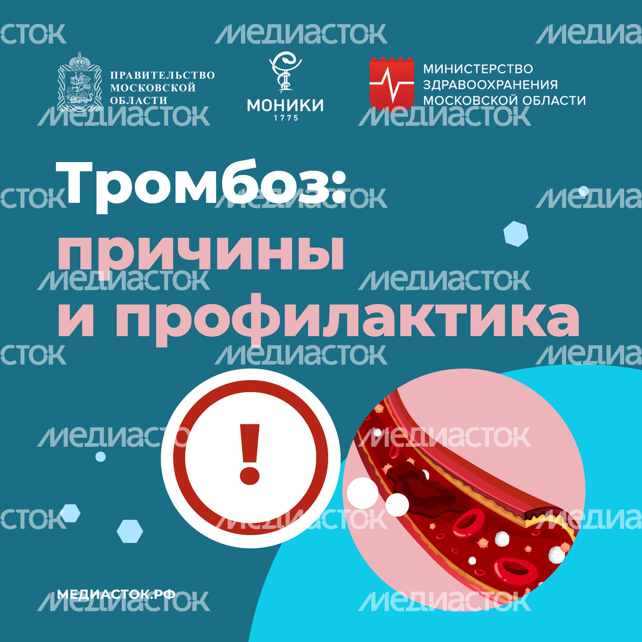 Тромбоз квадрат 01 Тромбоз квадрат 01