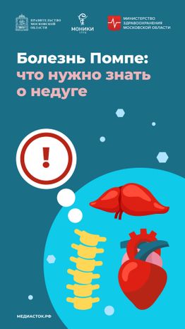 Болезнь Помпе вертикаль 01