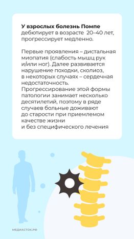 Болезнь Помпе вертикаль 06
