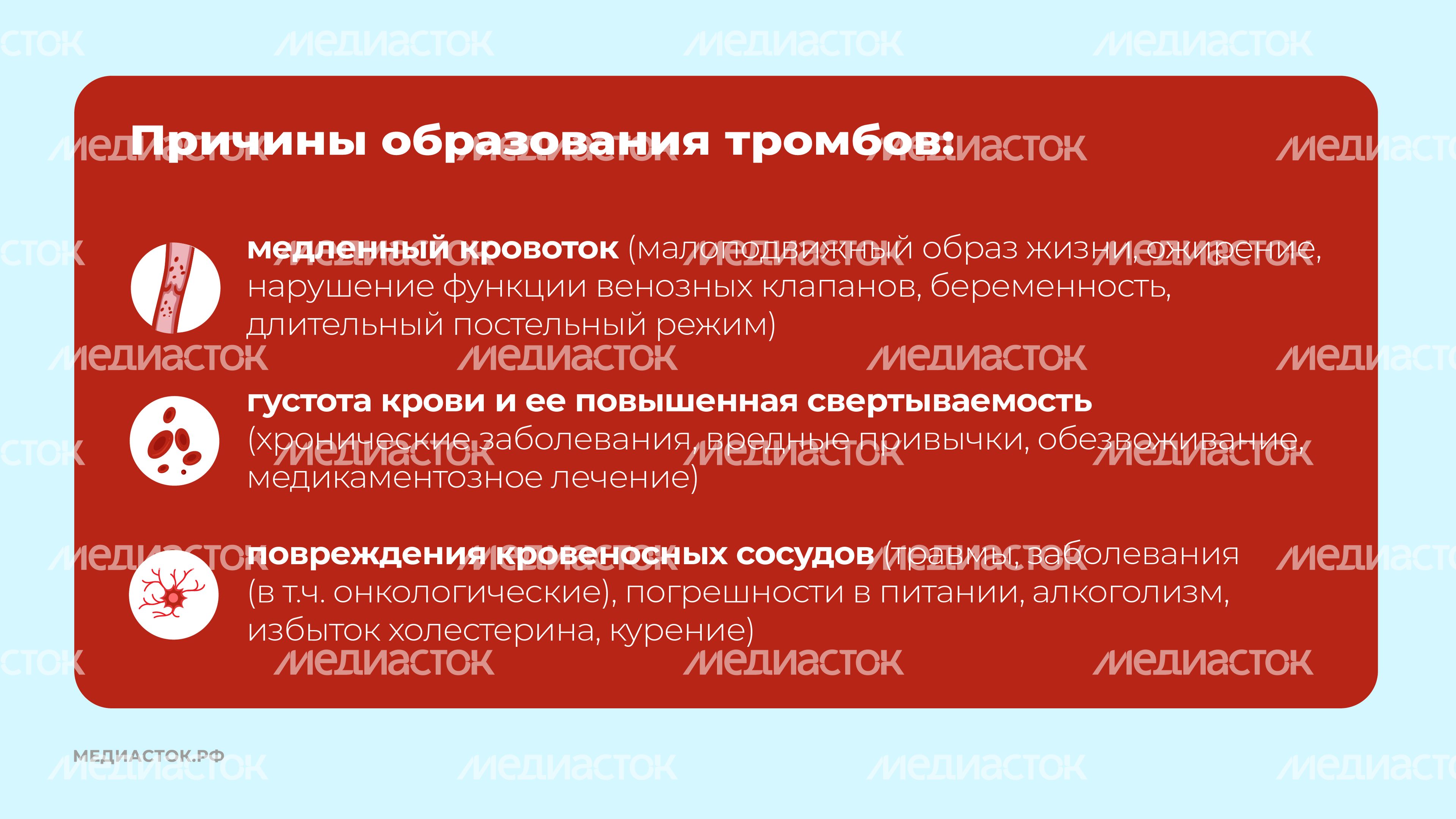 Тромбоз горизонталь 04 Тромбоз горизонталь 04