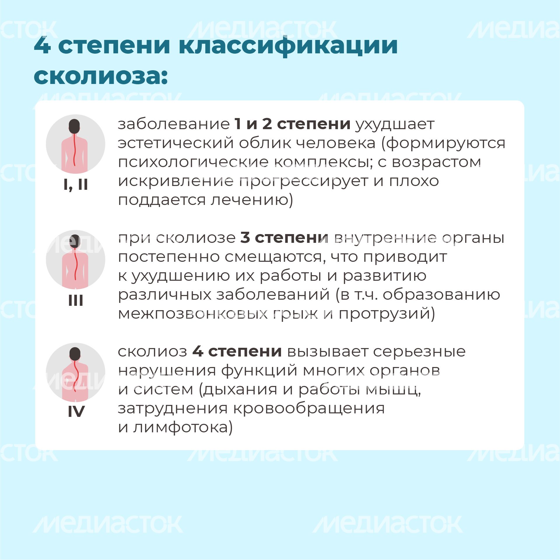 Чем опасен сколиоз квадрат (5) Чем опасен сколиоз квадрат (5)