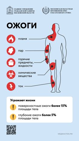 Первая помощь при ожогах Вертикаль 01