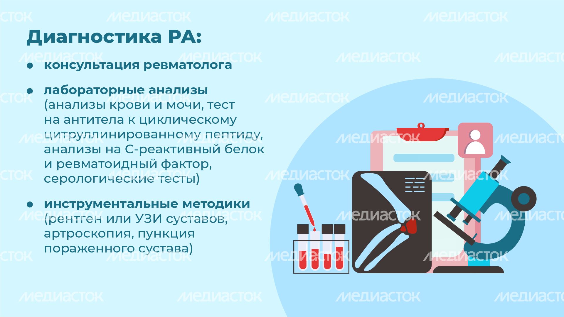Ревматоидный артрит - горизонталь-07