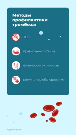 Тромбоз вертикаль 07