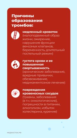Тромбоз вертикаль 04