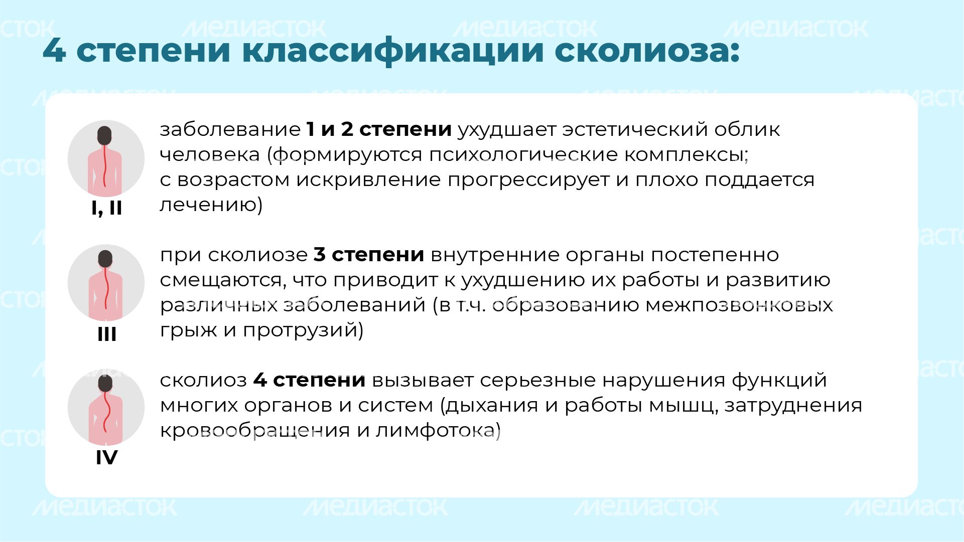 Чем опасен сколиоз горизонталь (5)