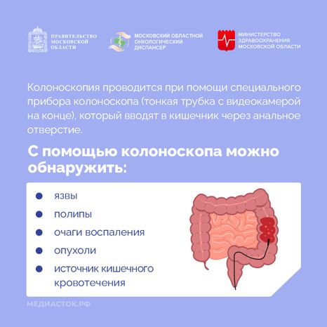 Колоноскопия квадрат 03